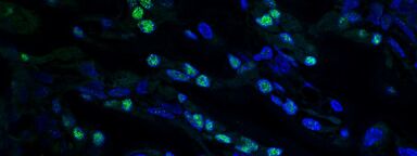 Osterix - Immunofluorescence