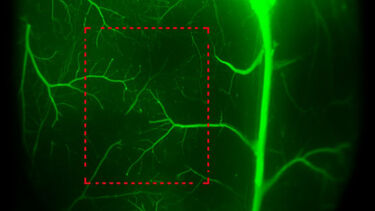 Mouse cerebral cortex with fluorescent dye highlighting vasculature