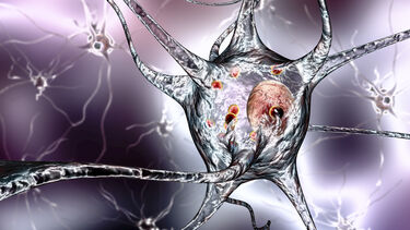 Parkinson's disease: nerve cells - illustration