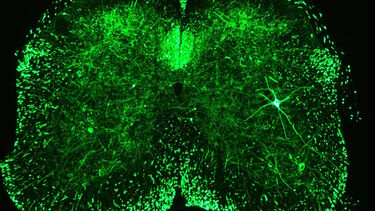 Transverse section of a spinal cord