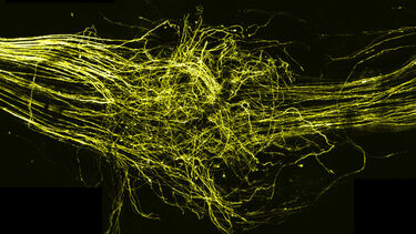 Neuroscience trigeminal repair 