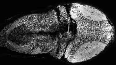 Zebrafish brain