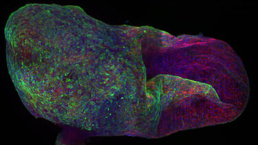 Human ESC-derived ear organoid