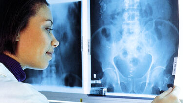 A student looking at an X-Ray picture