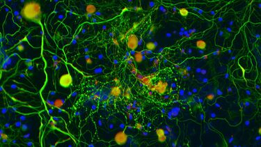 An image of composite nerves.