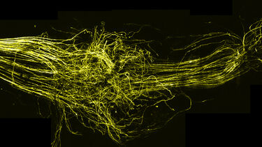 A visual representation of trigeminal nerve repair