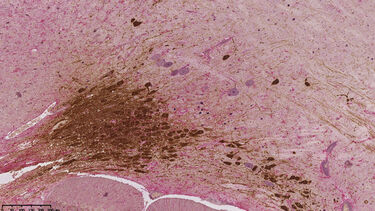 Immunohistochemistry