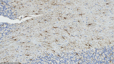 Immunohistochemistry