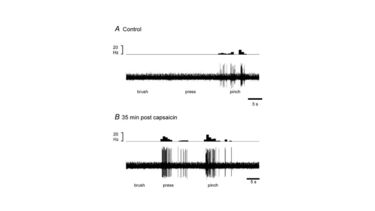 Electrophysiological recordings from a spinoparabrachial neuron