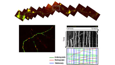 Measuring axonal transport.