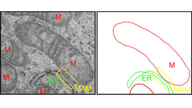 Visualization of MAM by transmission electron microscopy. Mitochondria are labelled with “M”.
