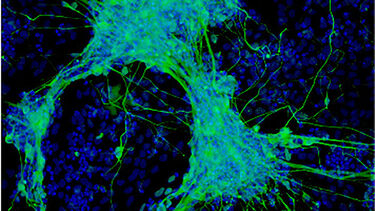 Example of a cluster of peripheral nervous system neurons