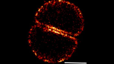 S.aureus cell wall synthesis