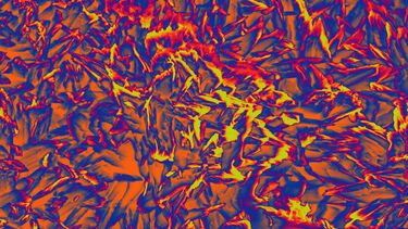 Scanning Electron Microscope Image