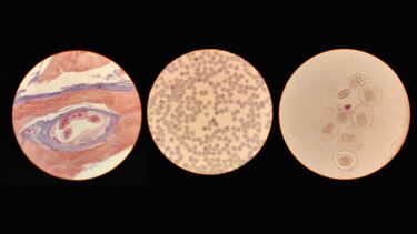Microscopic images of parasites