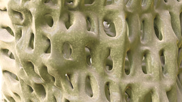 Bone health image