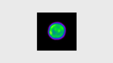 Laser developments