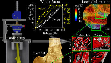 Graphical abstract - Damage tolerance and toughness of elderly human femora