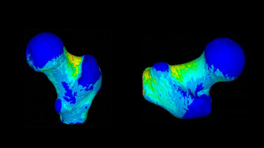 Patient-specific bone strength estimation from QCT data