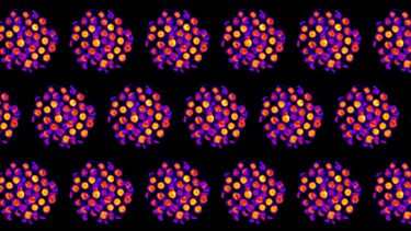 Chloroplasts imaged by SIM