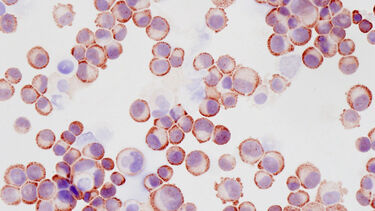 Head and Neck Cancer DEN diagram