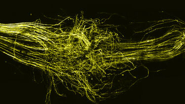 Image Neurons Dentistry