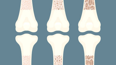 iHuman Bone Marrow