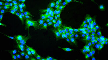 Head and Neck Cancer diagram DEN