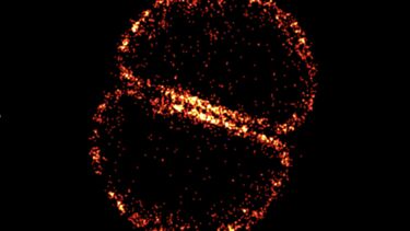 microscope image of MRSA bacteria 