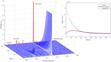 Kinetics of 13C pyruvate to lactate conversion