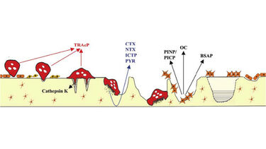 Bone biomarkers diagram