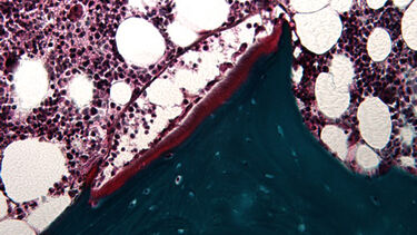 Goldner's trichrome of Human bone biopsy