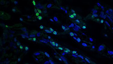 Osterix - Immunofluorescence