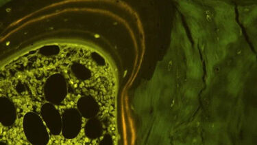 Fluorescent quadruple labelling of Human bone biopsy