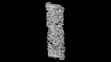 Human biopsy