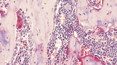 TRAP staining of mouse bone