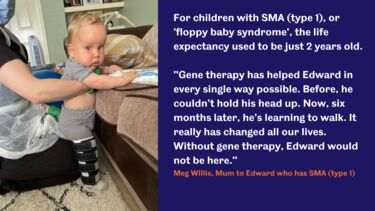 Edward standing up with leg braces helped by a nurse.