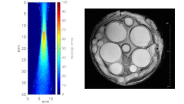 MR fluid velocity map of oil & a Spin echo image of a silkworm
