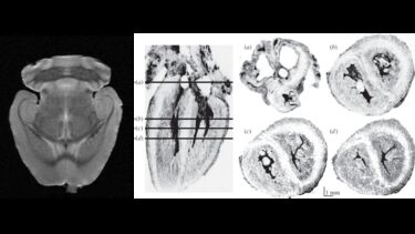Images of excised mouse brain and foetal heart