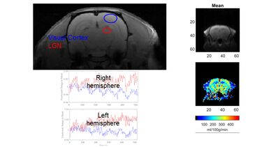 BOLD effect in a rat brain, and blood flow map in a mouse brain.