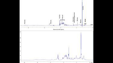 High-resolution NMR spectra of a biofluid and biopsy tissue sample