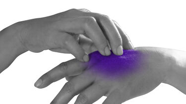 hands with skin condition