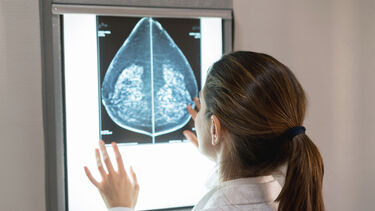 female gynocologist looking at a mammogram