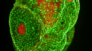 Image relating to multiple sclerosis