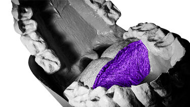 image of mouth model with nerve endings