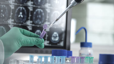 Conceptual image of clinical research