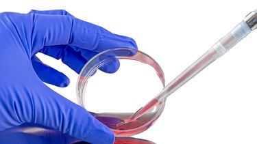 A culture dish with media in