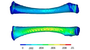 Diagram showing two deformed bones