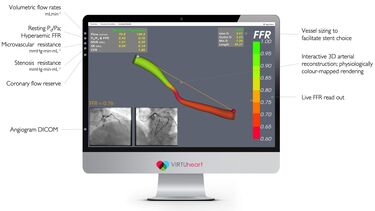 Image from the VIRTUheart™ workflow