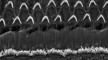 Example stereocilia SEM